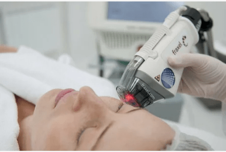 Atunṣe Laser